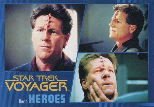 Star Trek Voyager gold parallel trading card featuring three headshots of a male character